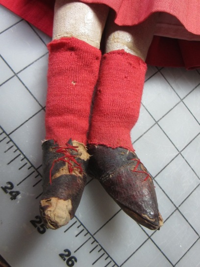 Red "socks" and leather shoes, a previous ankle repair.